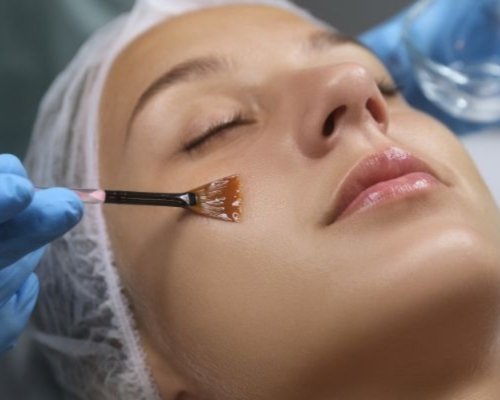 Chemical Peel in Roorkee